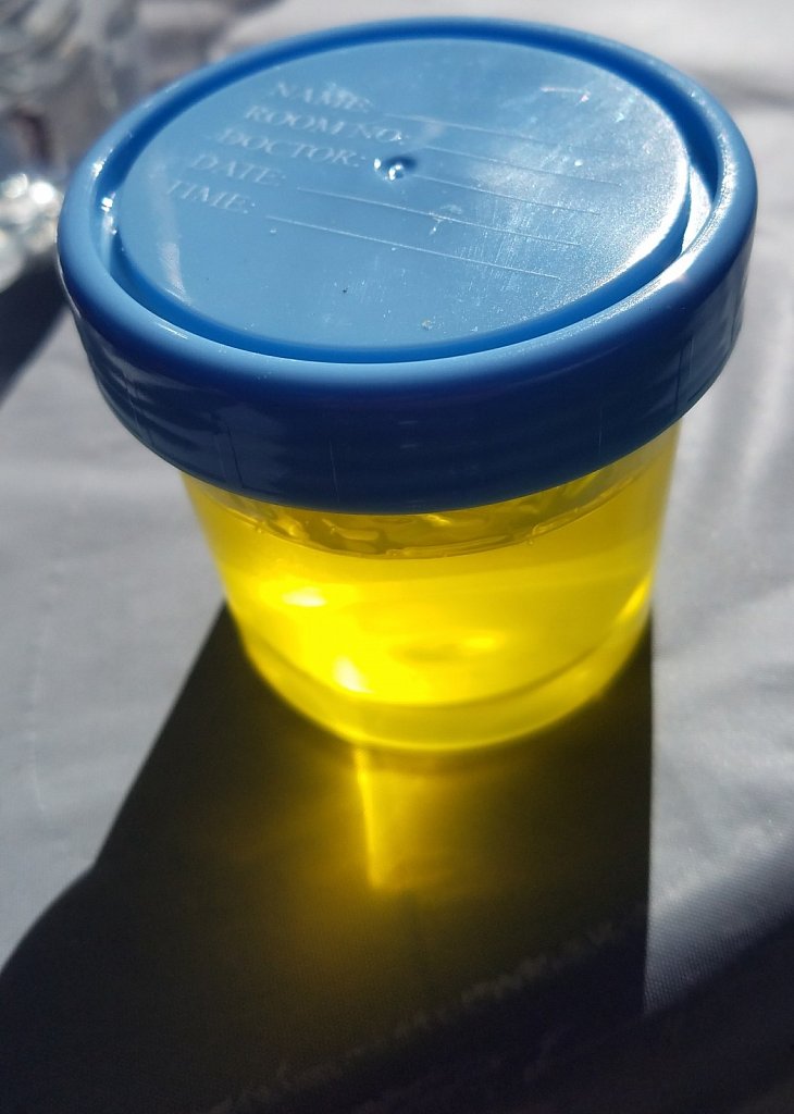 Jello Urine Sample